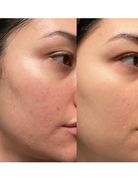Peeling renovador de textura de noche con retinol avanzado + ferúlico