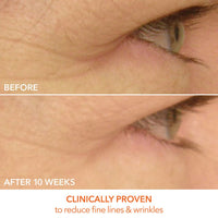 Paquete reafirmante para ojos y rostro de Skinny (20% de descuento)