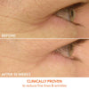 Paquete reafirmante para ojos y rostro de Skinny (20% de descuento)