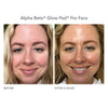 Alpha Beta® Glow Pad™ para rostro con brillo intenso